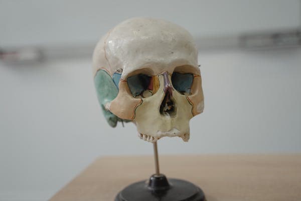 Craniofacial Surgery